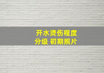 开水烫伤程度分级 初期照片